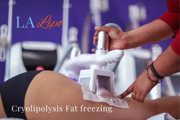 women getting fat freezing Market Harborough